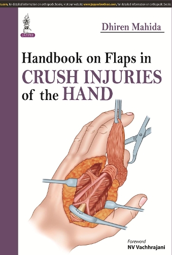 Бумажная книга «Handbook on Flaps in Crush Injuries of the Hand», автор Дхирен Махида - фото №1