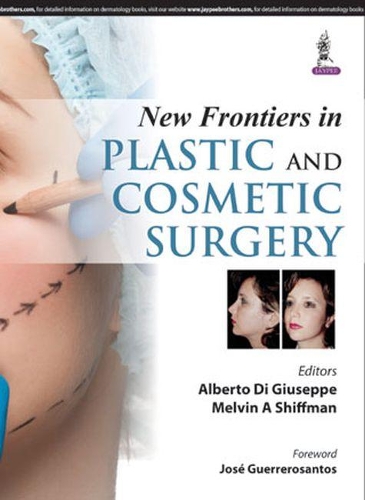 Паперова книга «New Frontiers in Plastic and Cosmetic Surgery», авторів Альберто Ді Джузеппе, Мелвін А. Шиффман - фото №1