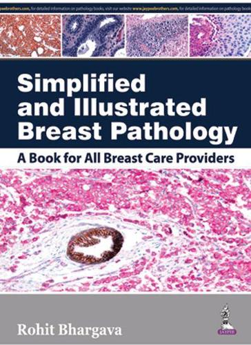 Паперова книга «Simplified and Illustrated Breast Pathology», автор Рохіт Бхаргава - фото №1