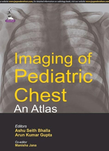 Бумажная книга «Imaging of Pediatric Chest - An Atlas», авторов Арун Кумар Гупта, Ашу Сейт Бхалла - фото №1