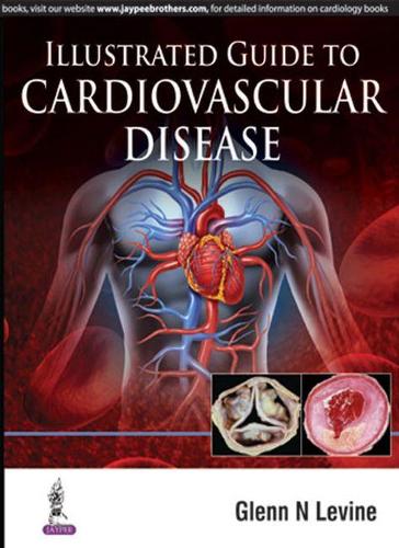 Паперова книга «Illustrated Guide to Cardiovascular Disease», автор Гленн Н. Левін - фото №1