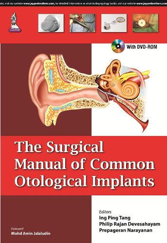 Бумажная книга «The Surgical Manual of Common Otological Implants», авторов Инг Пинг Танг, Филип Раджан Девесахаям, Препагеран Нараянан - фото №1