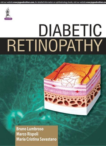 Паперова книга «Diabetic Retinopathy», авторів Бруно Лумброзо, Марко Рісполі, Марія Крістіна Савастано - фото №1