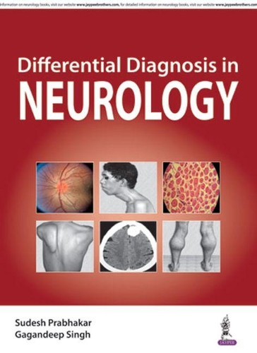 Бумажная книга «Differential Diagnosis in Neurology», авторов Гагандип Сингх, Судеш Прабхакар - фото №1