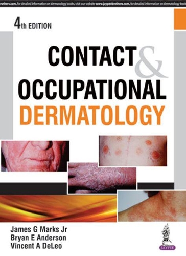 Бумажная книга «Contact & Occupational Dermatology», авторов Брайан Э. Андерсон, Джеймс Г. Маркс младший, Винсент А Делео - фото №1
