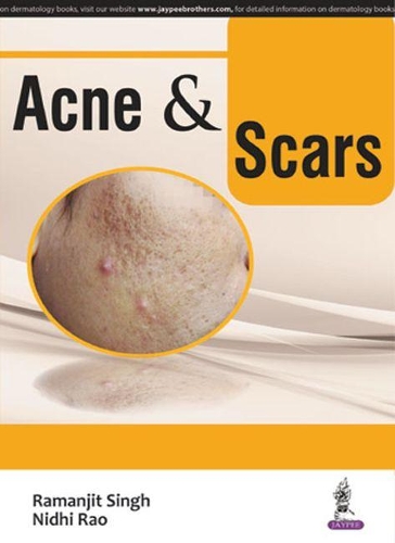 Паперова книга «Acne & Scars», авторів Нідхі Рао, Раманджит Сінгх - фото №1