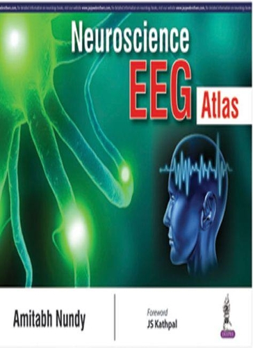 Бумажная книга «Neuroscience EEG Atlas», автор Амитабх Нунди - фото №1