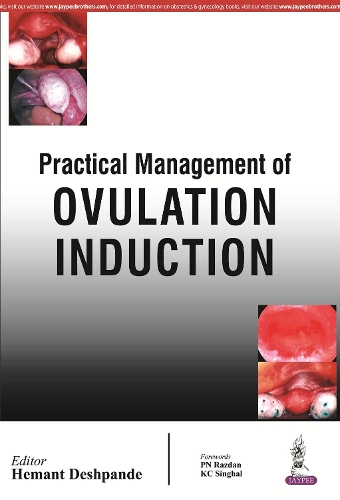 Паперова книга «Practical Management of Ovulation Induction», автор Хемант Дешпанде - фото №1