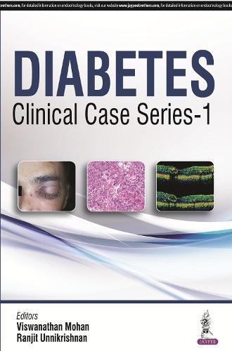 Паперова книга «Diabetes Clinical Case Series – 1», авторів Ранджит Уннікрішнан, В Мохан - фото №1