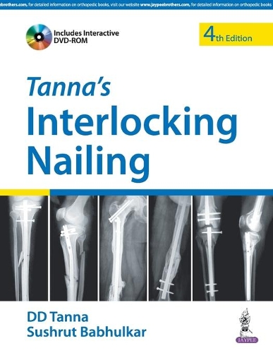 Паперова книга «Tanna's Interlocking Nailing», авторів ДД Танна, Сушрут Бабхулкар - фото №1