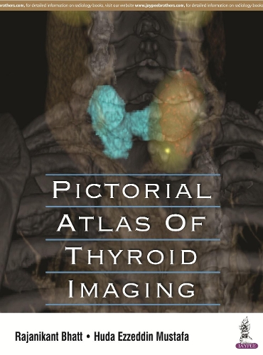 Бумажная книга «Pictorial Atlas of Thyroid Imaging», авторов Худа Эззеддин Мустафа, Раджаникант Бхатт - фото №1
