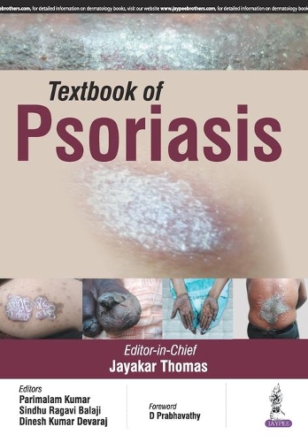 Бумажная книга «Textbook of Psoriasis», автор Джаякар Томас - фото №1
