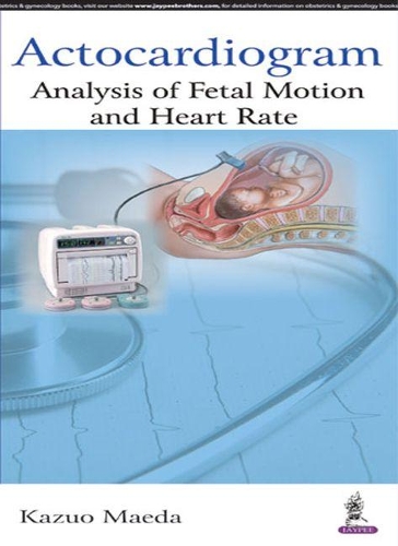 Бумажная книга «Actocardiogram: Analysis of Fetal Motion and Heart Rate», автор Кадзуо Маэда - фото №1