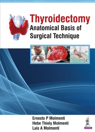 Паперова книга «Thyroidectomy: Anatomical Basis of Surgical Technique», авторів Ернесто П. Молменті, Хебе Тіолі Молменті, Луїс А. Молменті - фото №1