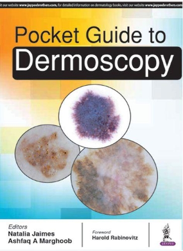 Паперова книга «Pocket Guide to Dermoscopy», авторів Ашфак А. Маргхуб, Наталія Хаймес - фото №1