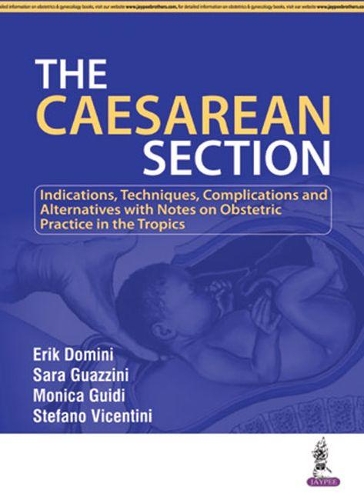 Паперова книга «The Caesarean Section», авторів Ерік Доміні, Моніка Гіді, Сара Гуацціні, Стефано Вічентіні - фото №1