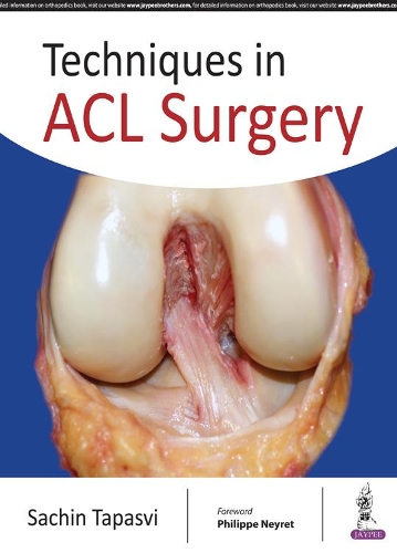 Паперова книга «Techniques in ACL Surgery», автор Сачін Тапасві - фото №1