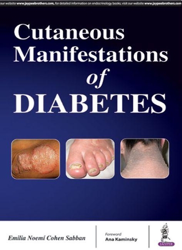 Бумажная книга «Cutaneous Manifestations of Diabetes», автор Коэн Саббан Эмилия - фото №1