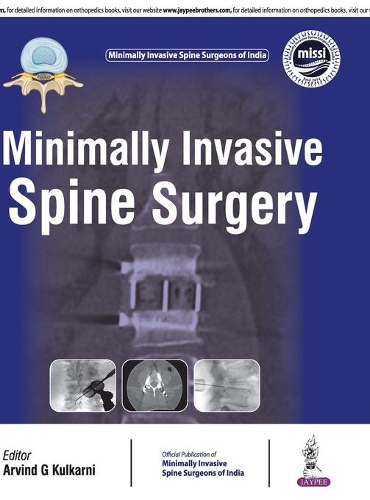 Бумажная книга «Minimally Invasive Spine Surgery», автор Арвинд Кулкарни - фото №1
