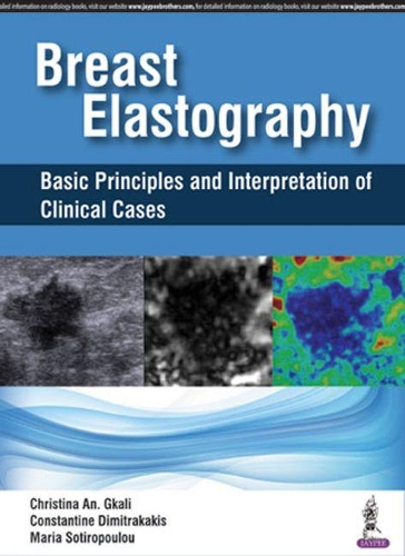 Паперова книга «Breast Elastography: Basic Principles and Interpretation of Clinical Cases», авторів Крістіна Ан Гкалі, Константін Дімітракакіс, Марія Сотіропулу - фото №1