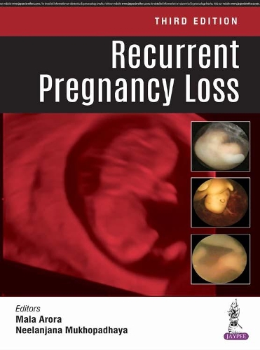 Бумажная книга «Recurrent Pregnancy Loss», авторов Мала Арора, Ниланджана Мухопадхая - фото №1