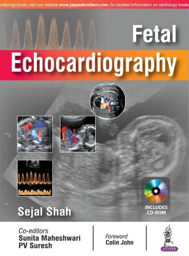 Паперова книга «Fetal Echocardiography», авторів Седжал Шах, Суніта Махешварі - фото №1