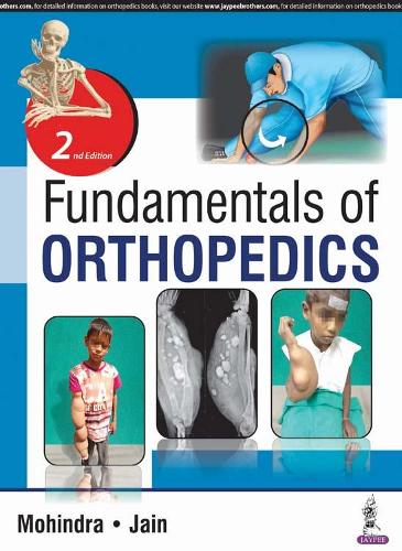 Бумажная книга «Fundamentals of Orthopedics», авторов Джитеш Кумар Джайн, Мукул Мохиндра - фото №1