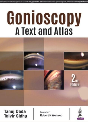 Паперова книга «Gonioscopy: A Text and Atlas», авторів Талвір Сідху, Танудж Дада - фото №1