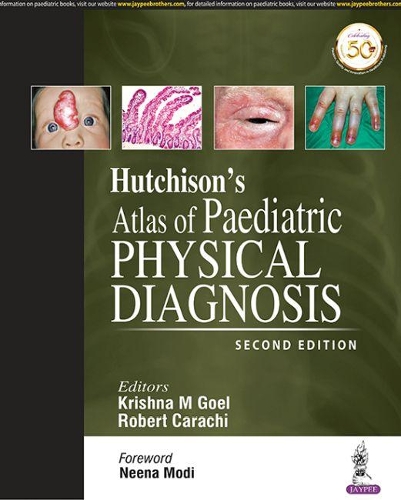 Бумажная книга «Hutchison's Atlas of Paediatric Physical Diagnosis», авторов Кришна М Гоэл, Роберт Карачи - фото №1