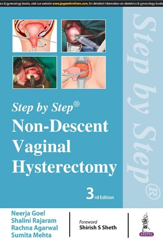 Паперова книга «Step by Step: Non-Descent Vaginal Hysterectomy», авторів Нірадж Гоел, Рахна Агарвал, Шаліні Раджарам, Суміта Мехта - фото №1