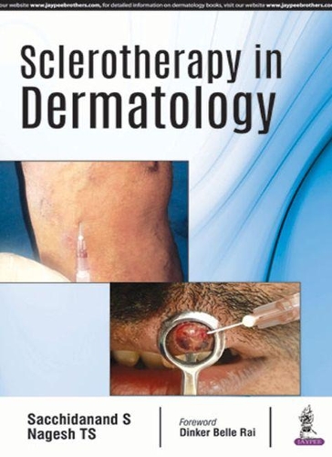 Бумажная книга «Sclerotherapy in Dermatology», авторов Нагеш ТС, Саччидананд С - фото №1