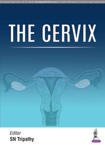 Бумажная книга «The Cervix», автор С.Н. Трипатхи - фото №1