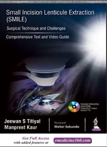 Бумажная книга «Small Incision Lenticule Extraction (SMILE): Surgical Technique and Challenges: Comprehensive Text and Video Guide», авторов Дживан С. Титиял, Манприт Каур - фото №1