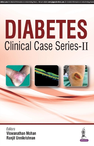 Бумажная книга «Diabetes Clinical Case Series – 2», авторов Ранджит Унникришнан, Вишванатан Мохан - фото №1