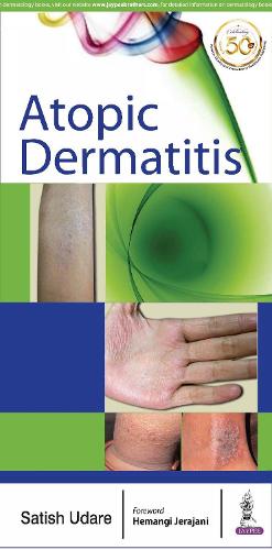 Бумажная книга «Atopic Dermatitis», автор Сатиш Ударе - фото №1