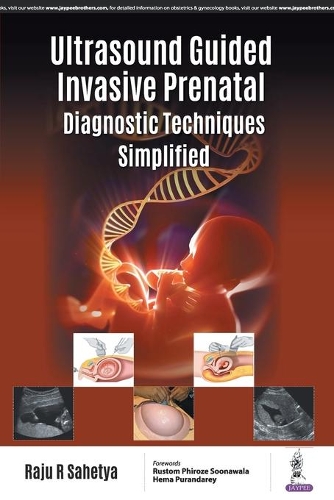 Бумажная книга «Ultrasound Guided Invasive Prenatal Diagnostic Techniques Simplified», автор Раджу Р Сахетия - фото №1