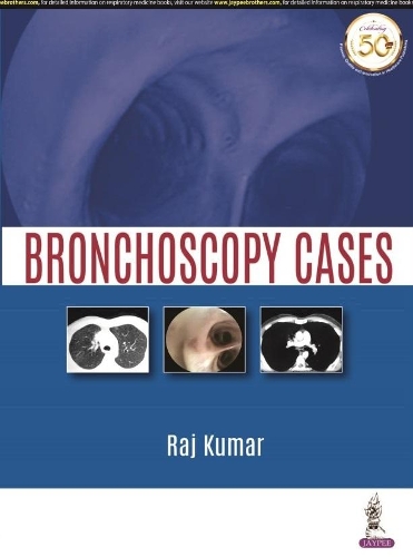 Бумажная книга «Bronchoscopy Cases», автор Радж Кумар - фото №1