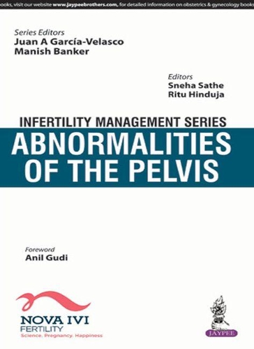 Бумажная книга «Infertility Management Series: Abnormalities of the Pelvis», авторов Хуан А Гарсия-Веласко, Маниш Банкер, Риту Хиндуджа, Снеха Сатхе - фото №1