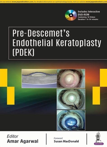 Бумажная книга «Pre-Descemet’s Endothelial Keratoplasty (PDEK)», автор Амар Агарвал - фото №1