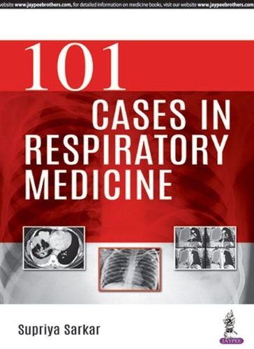 Бумажная книга «101 Cases in Respiratory Medicine», автор Суприя Саркар - фото №1