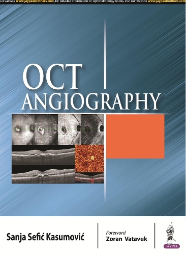Бумажная книга «OCT Angiography», автор Саня Сефик Касумович - фото №1