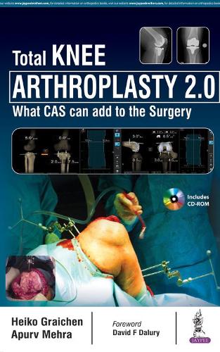 Паперова книга «Total Knee Arthroplasty 2.0: What CAS can add to the Surgery», авторів Апурв Мехра, Хейко Грейхен - фото №1