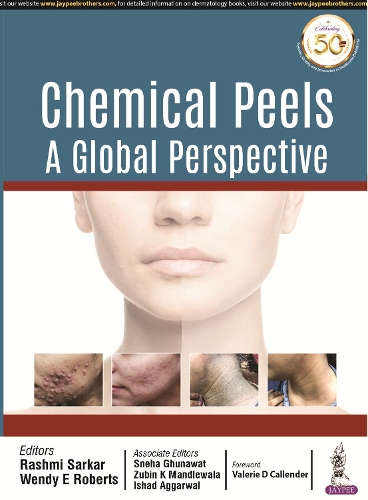 Паперова книга «Chemical Peels: A Global Perspective», авторів Ішад Аґґарвал, Рашмі Саркар, Снеха Гунават, Венді Е. Робертс, Зубін К. Мандлевала - фото №1