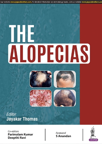 Паперова книга «The Alopecias», автор Джаякар Томас - фото №1