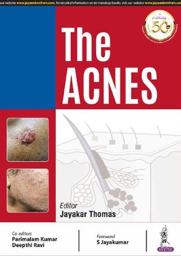 Бумажная книга «The Acnes», авторов Дипти Рави, Джаякар Томас, Парималам Кумар - фото №1