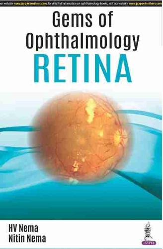 Бумажная книга «Gems of Ophthalmology: Retina», авторов Х. В. Нема, Нитин Нема - фото №1