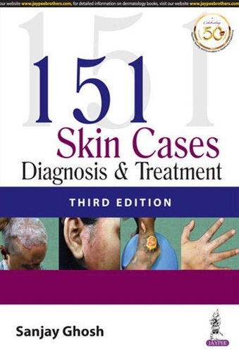 Бумажная книга «151 Skin Cases: Diagnosis & Treatment», автор Санджай Гхош - фото №1