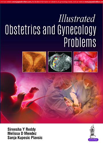 Паперова книга «Illustrated Obstetrics and Gynecology Problems», авторів Мелісса Д. Мендес, Саня Купешич Плавшич, Сіріша Й Редді - фото №1