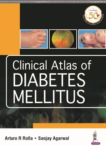 Паперова книга «Clinical Atlas of Diabetes Mellitus», авторів Артуро Р Ролла, Санджай Агарвал - фото №1