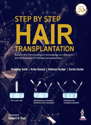 Бумажная книга «Step by Step Hair Transplantation», авторов Абхинав Кумар, Арика Бансал, Прадип Сетхи, Сарита Санке - фото №1
